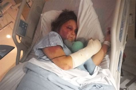 kirra hart news australia|Teen victim of brutal alleged bashing speaks out。